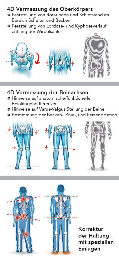 Optimetrische Wirbelsäulenvermessung